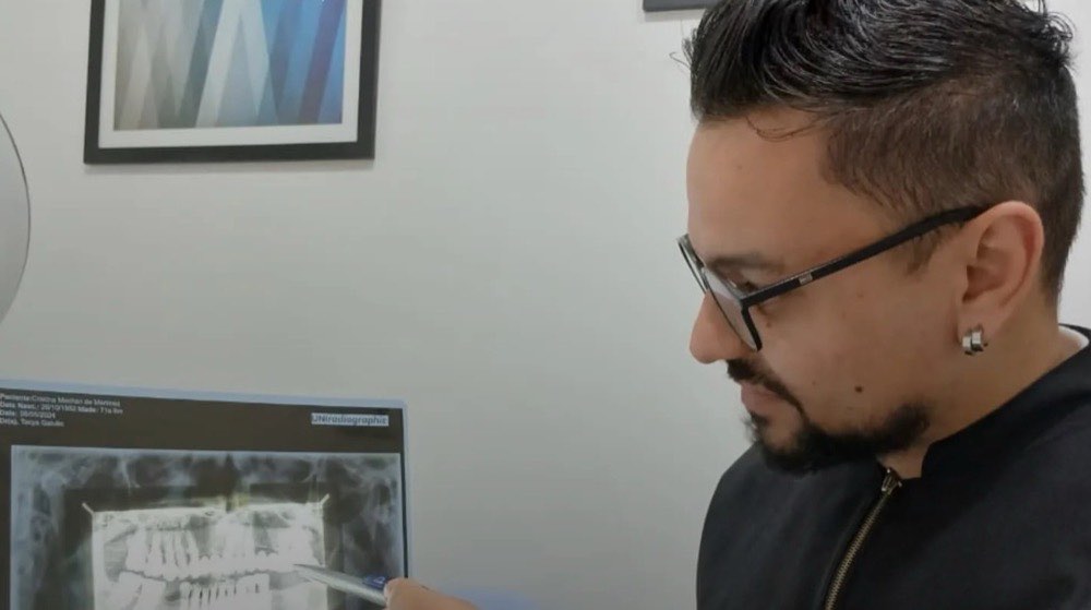 Dr. Ramon Peres analisando uma radiografia panorâmica no consultório